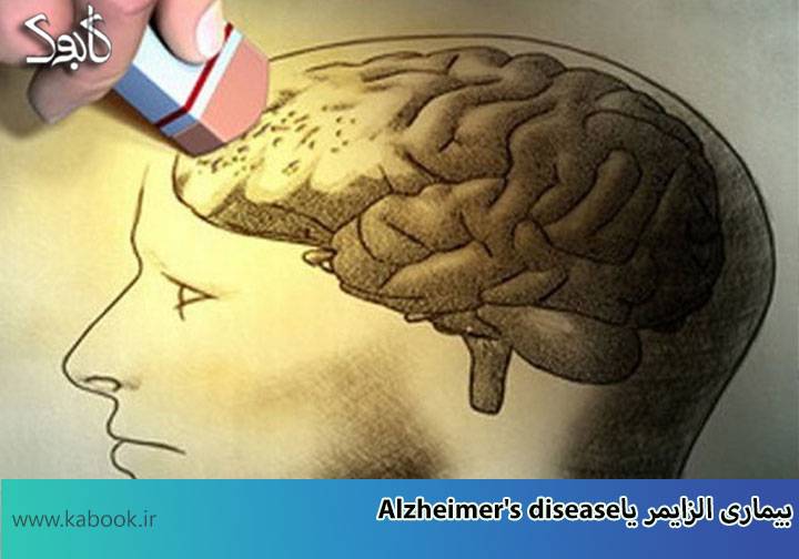 Alzheimers disease12 - هر آنچه که باید در مورد آلزایمر بدانید