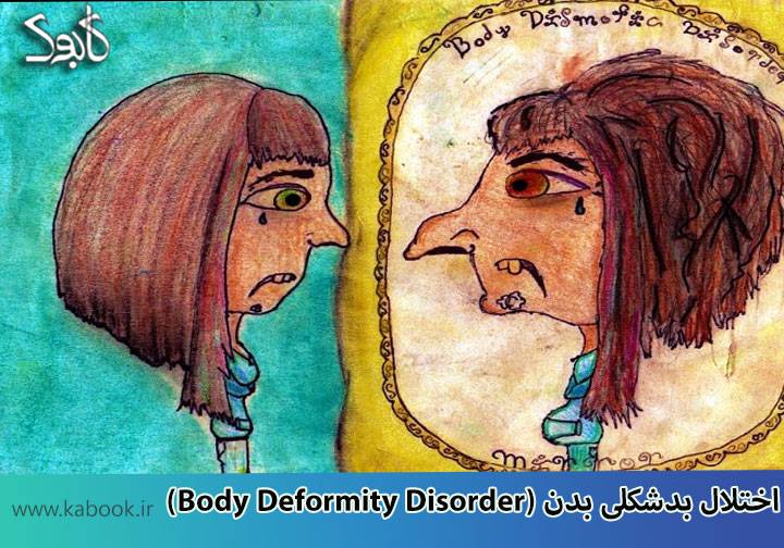 Body Deformity Disorder - اختلال بدشکلی بدن (BDD)